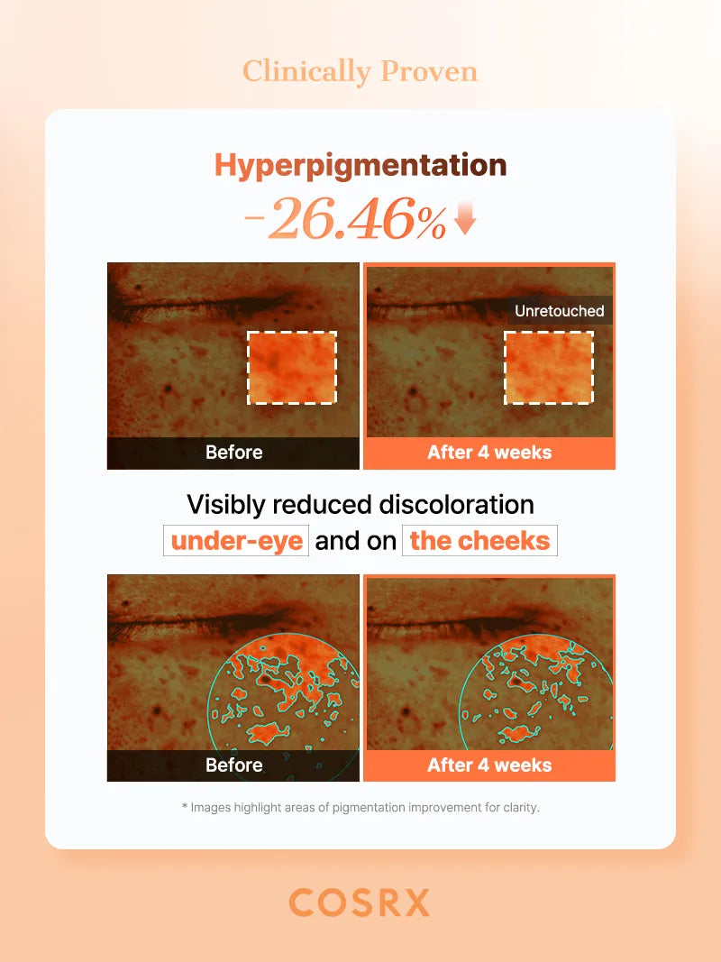 COSRX 5 PDRN Collagen Vitalizing Hydrogel Eye Patch