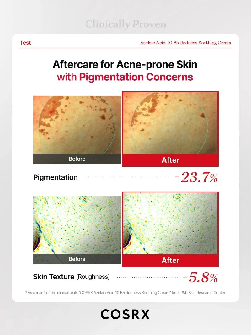 COSRX Azelaic Acid 10 B5 Redness Soothing Cream