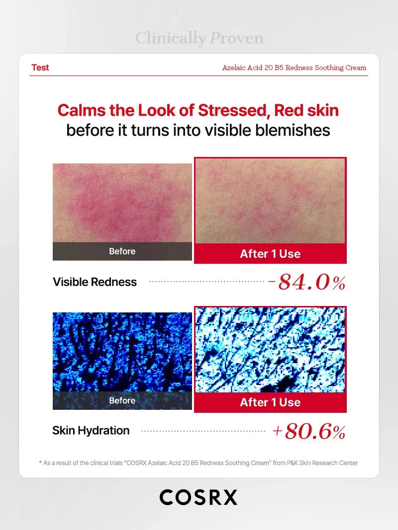 COSRX Azelaic Acid 20 B5 Redness Soothing Cream