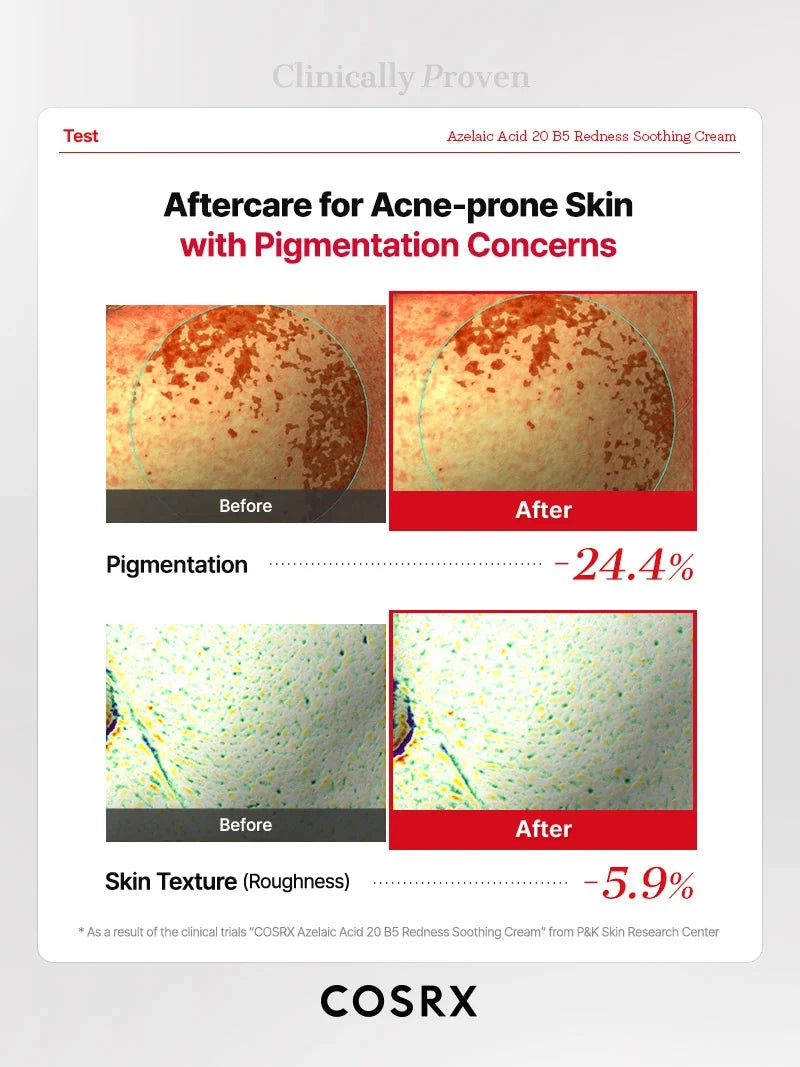 COSRX Azelaic Acid 20 B5 Redness Soothing Cream