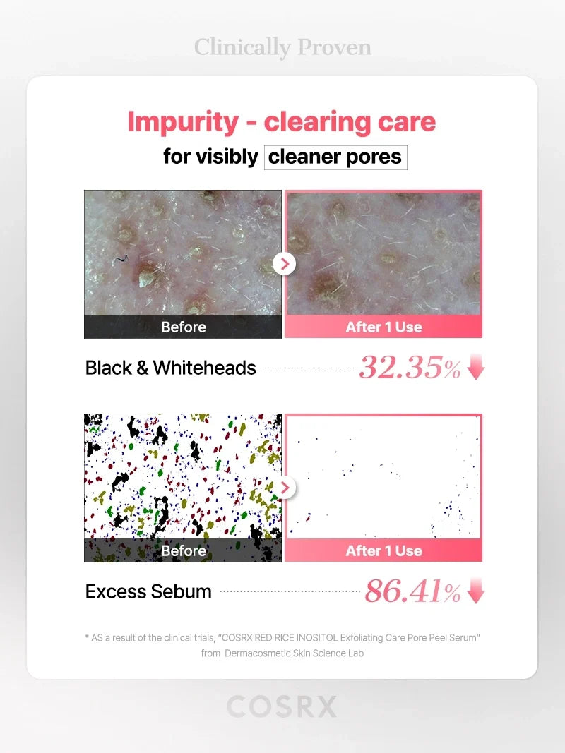 COSRX RED RICE INOSITOL Exfoliating Care Pore Wash-Off Peel Serum